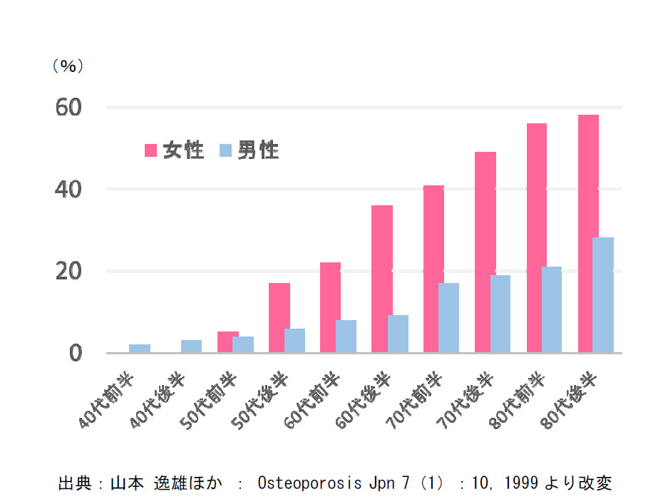 ※2 骨粗しょう症の年代別有病率